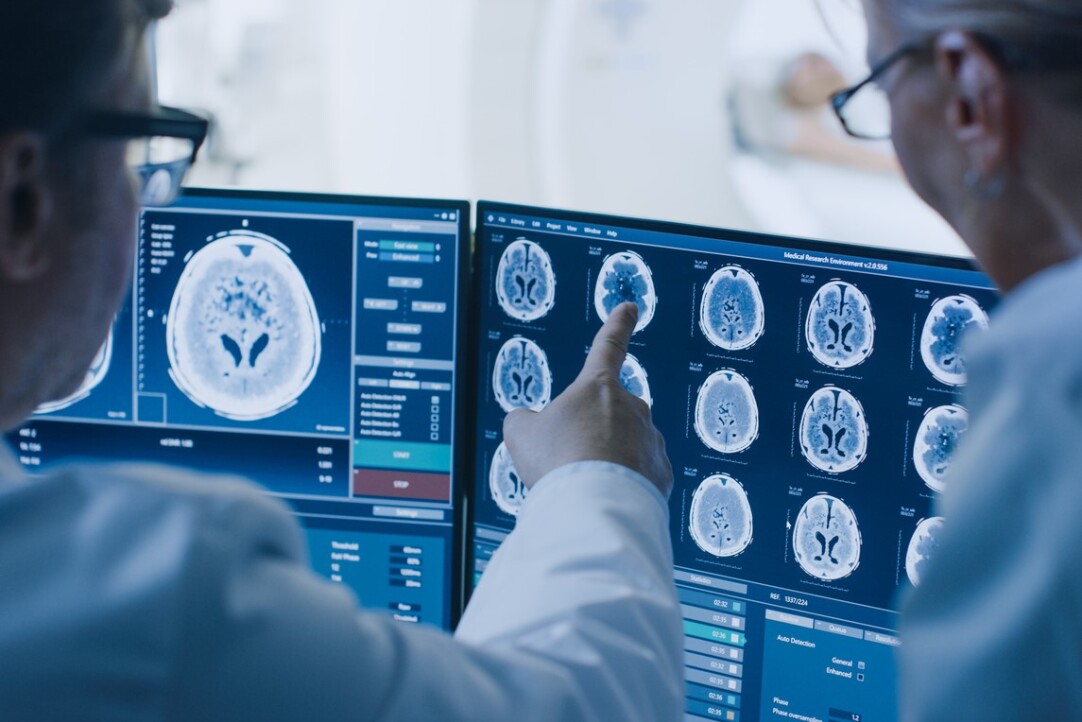 Illustration for news: Machine Learning Links Two New Genes to Ischemic Stroke